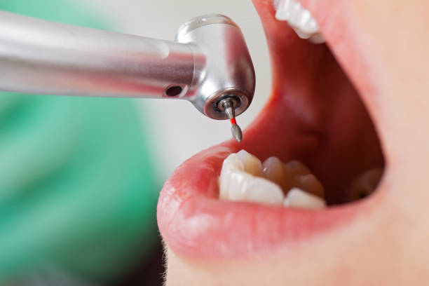 Best Pediatric Emergency Dentist in Elgin, OK